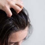 Kepekten kurtulmanın doğal yolları